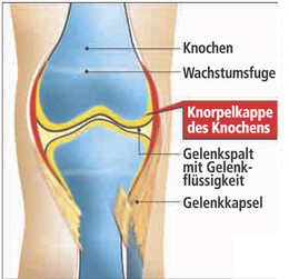 Arthrosen, Knorpel, Gelenksverschleiß, Regenerationsfähigkeit