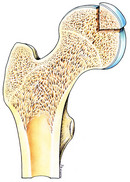 Schenkelhals, Hüftkopf, Arthrose, Arthrosen, Knorpel, Gelenksverschleiß, Regenerationsfähigkeit, Knorpelveränderung